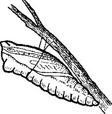 Illustration of chrysalis